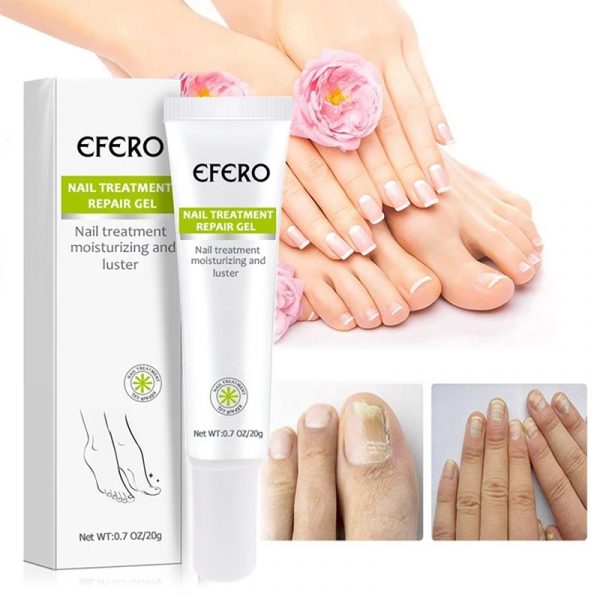 Nail Repair and Fungus Treatment Solution